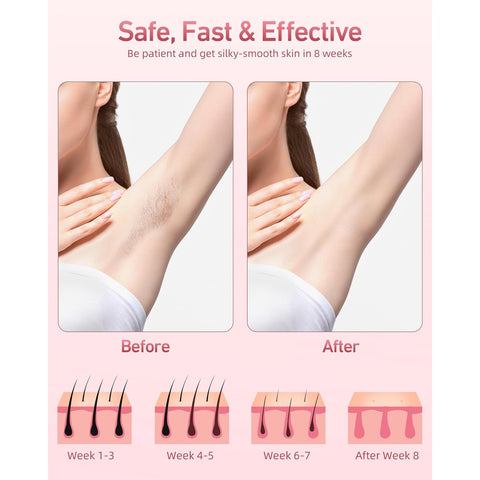 Hair Removal Device, IPL Hair Removal, Laser Hair Removal for Women and Men 999,999 Flashes Permanent for Facial Facial Legs Arms Bikini Line Whole Body Use at-Home(Model: TFDA06S-A)