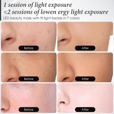 Red Light Therapy for Face, 7 Colors LED Face Mask Light Therapy At Home, Led Face Mask Light Therapy